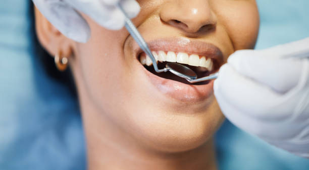 Best Emergency Dental Care for Broken or Chipped Teeth in Germantown, MD